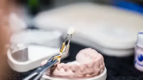 What is the Cost of Dental Bonding?